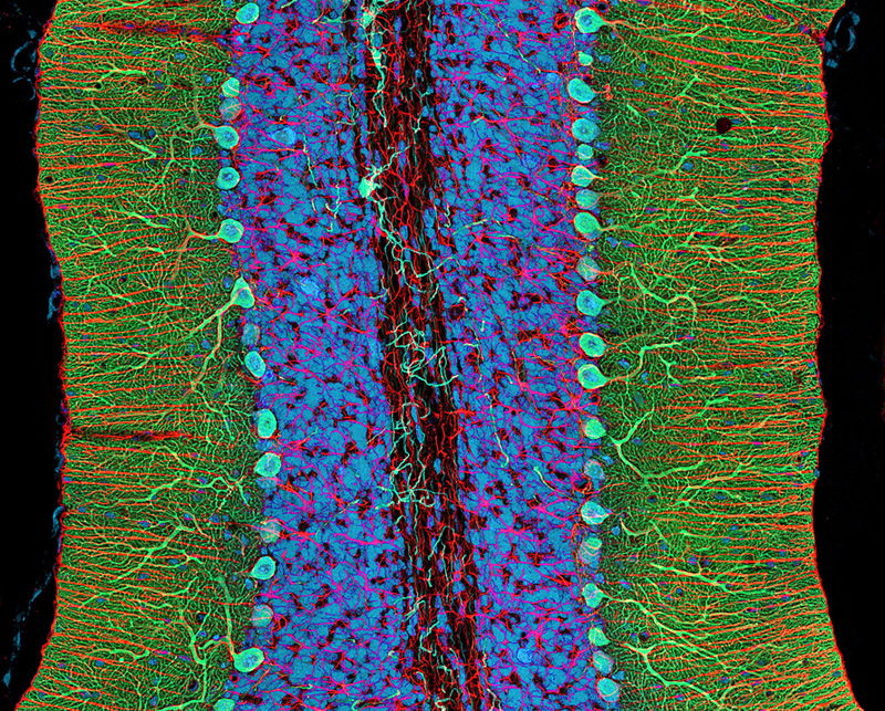 cellule de cerveau vue au microscope