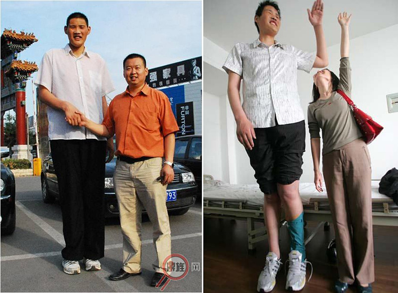 Zhao Liang, l'homme vivant le plus grand au monde