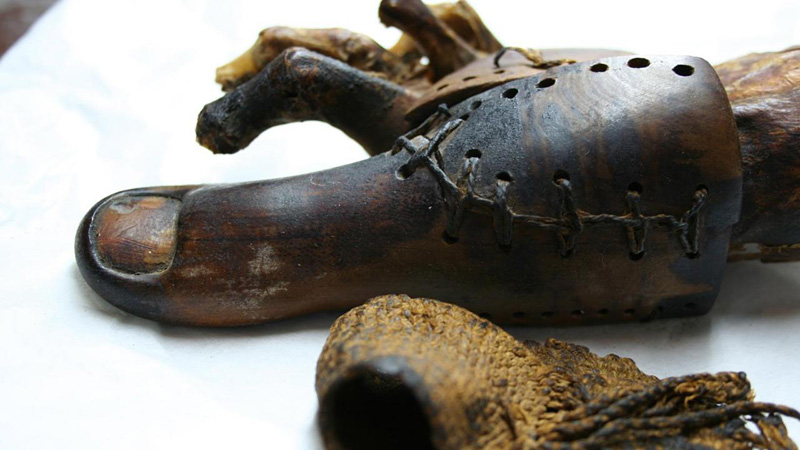 La plus ancienne prothèse du monde, vieille de 3000 ans