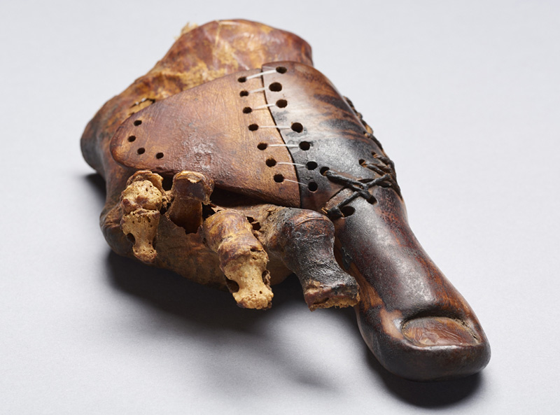 La plus ancienne prothèse du monde, vieille de 3000 ans